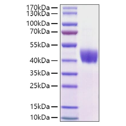 SDS-PAGE - Recombinant Mouse Mesothelin Protein (C-terminal His Tag) (A331752) - Antibodies.com