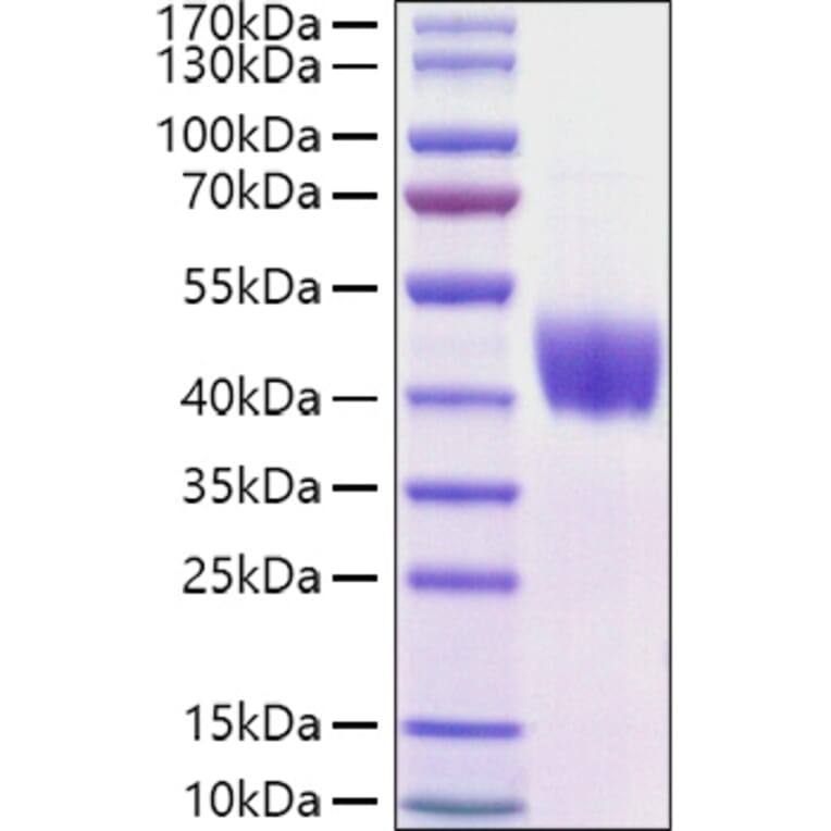 SDS-PAGE - Recombinant Mouse Mesothelin Protein (C-terminal His Tag) (A331752) - Antibodies.com