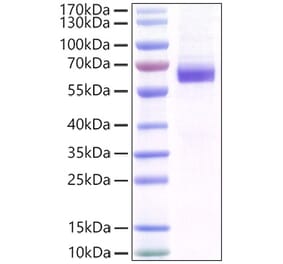 SDS-PAGE - Recombinant Mouse MFG-E8 Protein (C-terminal His Tag) (A331753) - Antibodies.com