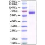 SDS-PAGE - Recombinant Mouse MFG-E8 Protein (C-terminal His Tag) (A331753) - Antibodies.com