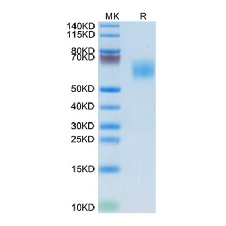 Tris-Bis PAGE - Recombinant Human MIC-A Protein (Biotin) (C-terminal His and Avi Tag) (A331754) - Antibodies.com