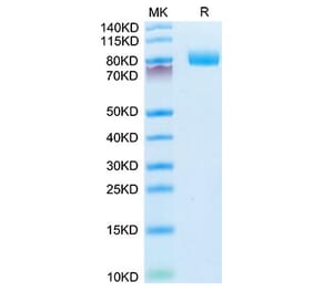 Tris-Bis PAGE - Recombinant Mouse CD10 Protein (N-terminal His Tag) (A331756) - Antibodies.com