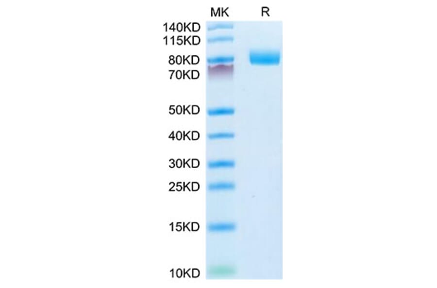 Tris-Bis PAGE - Recombinant Mouse CD10 Protein (N-terminal His Tag) (A331756) - Antibodies.com