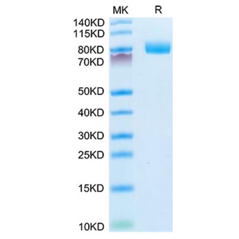 Tris-Bis PAGE - Recombinant Mouse CD10 Protein (N-terminal His Tag) (A331756) - Antibodies.com