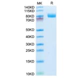 Tris-Bis PAGE - Recombinant Mouse CD10 Protein (N-terminal His Tag) (A331756) - Antibodies.com
