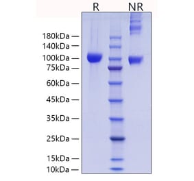 SDS-PAGE - Recombinant Mouse MMP9 Protein (C-terminal His Tag) (A331757) - Antibodies.com