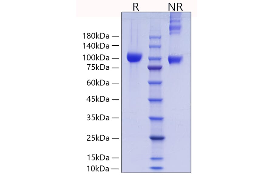 SDS-PAGE - Recombinant Mouse MMP9 Protein (C-terminal His Tag) (A331757) - Antibodies.com