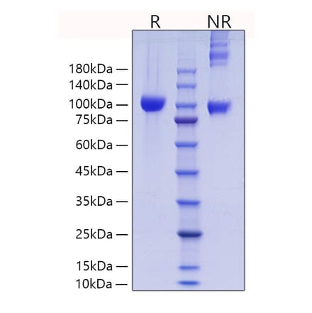 SDS-PAGE - Recombinant Mouse MMP9 Protein (C-terminal His Tag) (A331757) - Antibodies.com