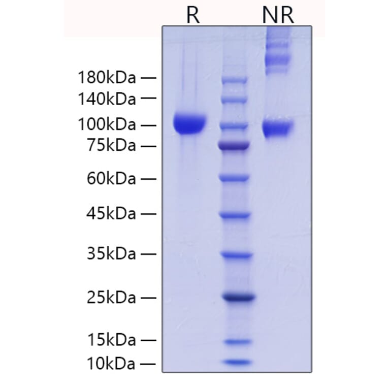 SDS-PAGE - Recombinant Mouse MMP9 Protein (C-terminal His Tag) (A331757) - Antibodies.com