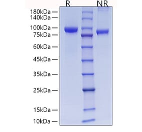 SDS-PAGE - Recombinant Rat MMP9 Protein (C-terminal His Tag) (A331758) - Antibodies.com