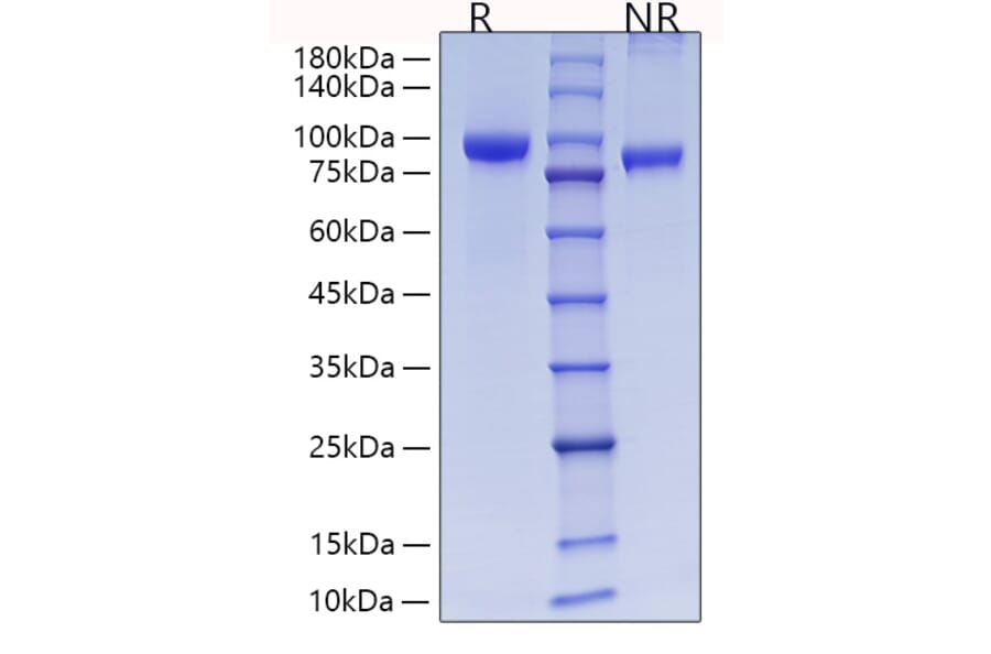 SDS-PAGE - Recombinant Rat MMP9 Protein (C-terminal His Tag) (A331758) - Antibodies.com