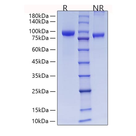 SDS-PAGE - Recombinant Rat MMP9 Protein (C-terminal His Tag) (A331758) - Antibodies.com