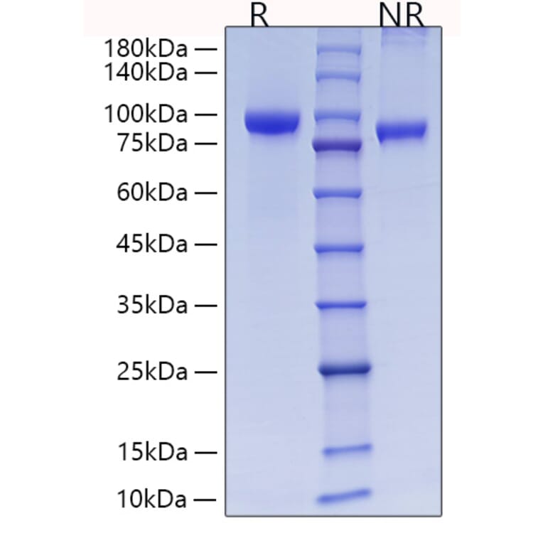 SDS-PAGE - Recombinant Rat MMP9 Protein (C-terminal His Tag) (A331758) - Antibodies.com