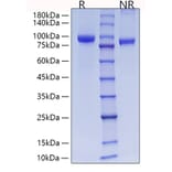 SDS-PAGE - Recombinant Rat MMP9 Protein (C-terminal His Tag) (A331758) - Antibodies.com