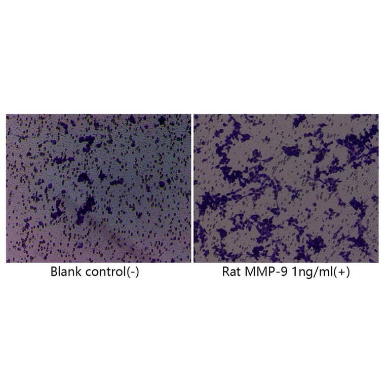 Cell Migration Assay - Recombinant Rat MMP9 Protein (C-terminal His Tag) (A331758) - Antibodies.com