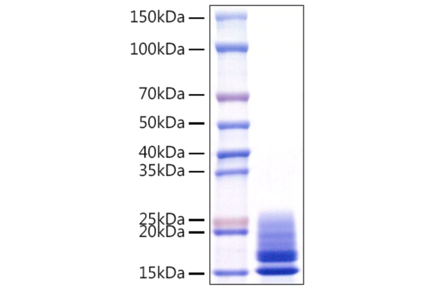 SDS-PAGE - Recombinant Monkeypox virus A29 Protein (C-terminal His Tag) (A331759) - Antibodies.com