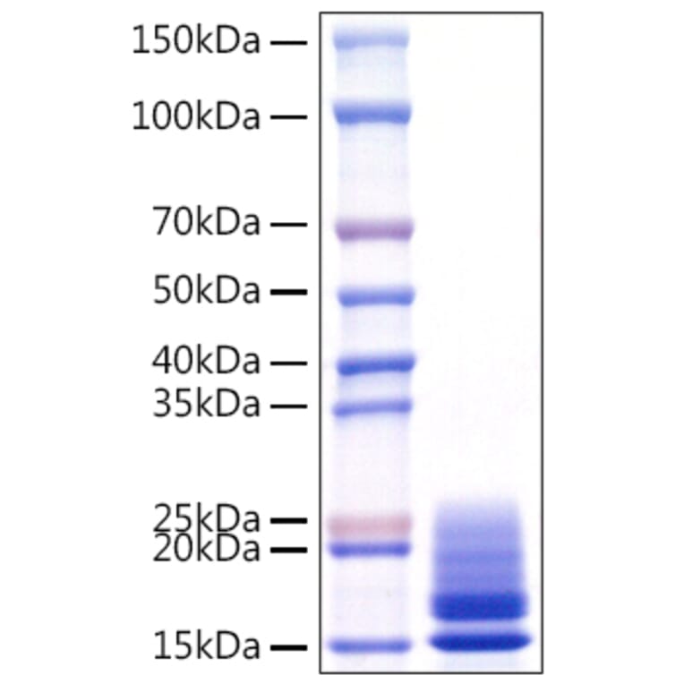 SDS-PAGE - Recombinant Monkeypox virus A29 Protein (C-terminal His Tag) (A331759) - Antibodies.com
