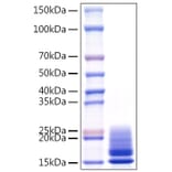 SDS-PAGE - Recombinant Monkeypox virus A29 Protein (C-terminal His Tag) (A331759) - Antibodies.com