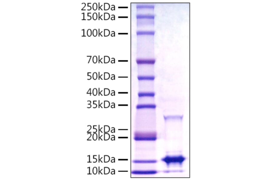 SDS-PAGE - Recombinant Monkeypox virus A29 Protein (C-terminal His Tag) (A331760) - Antibodies.com