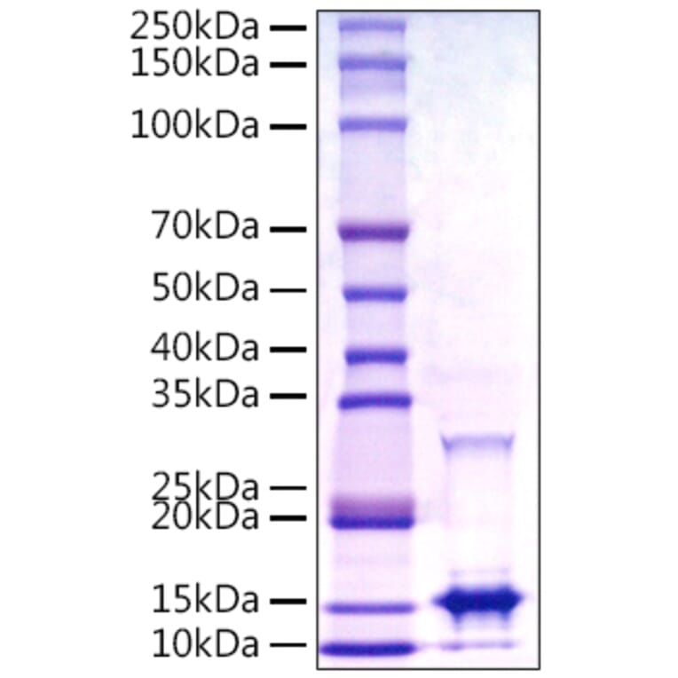 SDS-PAGE - Recombinant Monkeypox virus A29 Protein (C-terminal His Tag) (A331760) - Antibodies.com