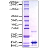 SDS-PAGE - Recombinant Monkeypox virus A29 Protein (C-terminal His Tag) (A331760) - Antibodies.com