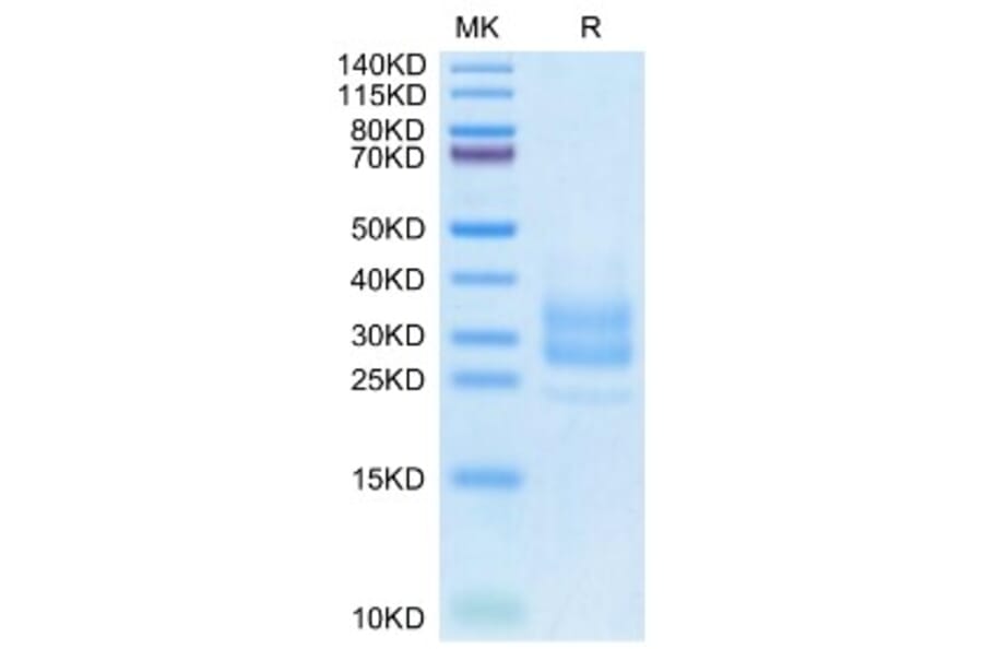 SDS-PAGE - Recombinant Monkeypox virus M1R Protein (C-terminal His Tag) (A331761) - Antibodies.com
