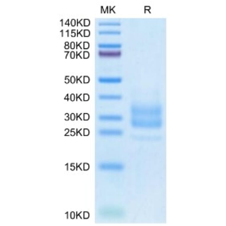 SDS-PAGE - Recombinant Monkeypox virus M1R Protein (C-terminal His Tag) (A331761) - Antibodies.com