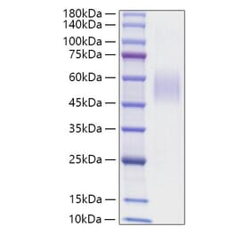 SDS-PAGE - Recombinant Mouse CD204 Protein (N-terminal His Tag) (A331762) - Antibodies.com