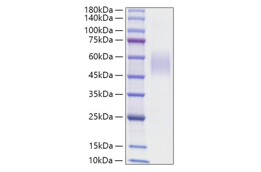 SDS-PAGE - Recombinant Mouse CD204 Protein (N-terminal His Tag) (A331762) - Antibodies.com