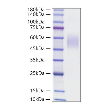 SDS-PAGE - Recombinant Mouse CD204 Protein (N-terminal His Tag) (A331762) - Antibodies.com