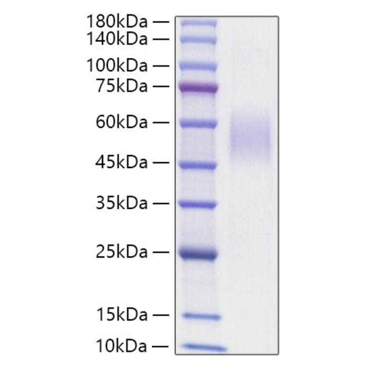SDS-PAGE - Recombinant Mouse CD204 Protein (N-terminal His Tag) (A331762) - Antibodies.com