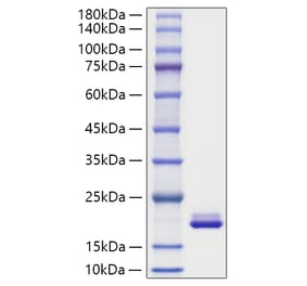 SDS-PAGE - Recombinant Mouse MYDGF Protein (C-terminal His Tag) (A331763) - Antibodies.com