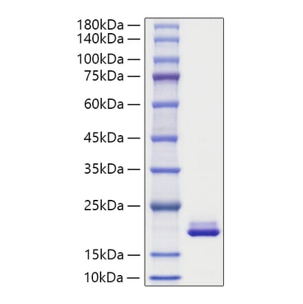 SDS-PAGE - Recombinant Mouse MYDGF Protein (C-terminal His Tag) (A331763) - Antibodies.com