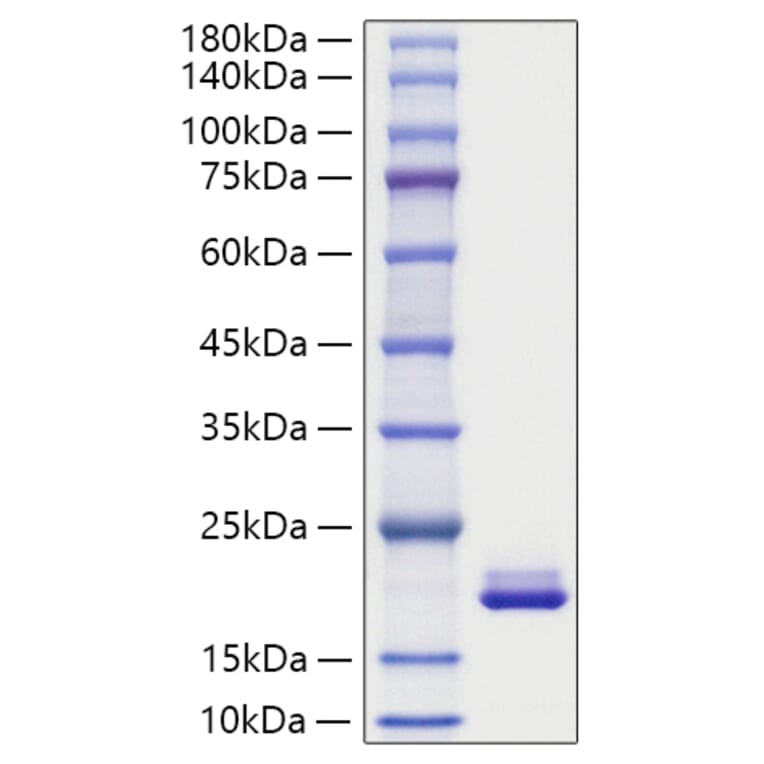 SDS-PAGE - Recombinant Mouse MYDGF Protein (C-terminal His Tag) (A331763) - Antibodies.com