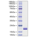 SDS-PAGE - Recombinant Mouse MYDGF Protein (C-terminal His Tag) (A331763) - Antibodies.com