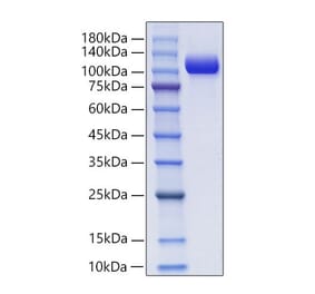 SDS-PAGE - Recombinant Mouse NCAM1 Protein (C-terminal His and Avi Tag) (A331764) - Antibodies.com