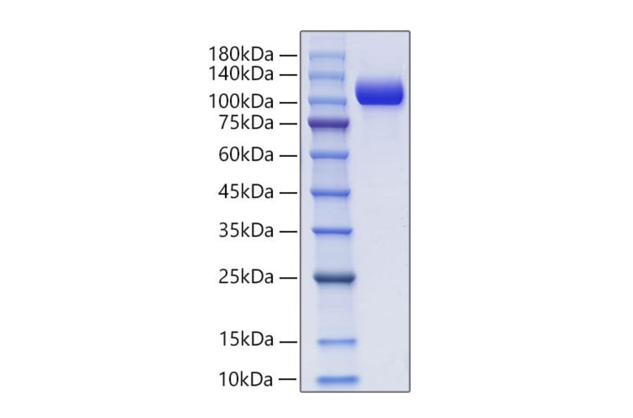 SDS-PAGE - Recombinant Mouse NCAM1 Protein (C-terminal His and Avi Tag) (A331764) - Antibodies.com