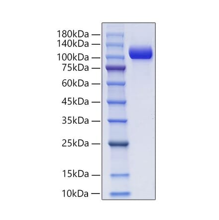 SDS-PAGE - Recombinant Mouse NCAM1 Protein (C-terminal His and Avi Tag) (A331764) - Antibodies.com