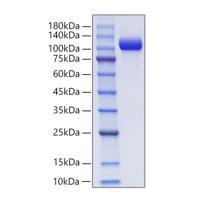 SDS-PAGE - Recombinant Mouse NCAM1 Protein (C-terminal His and Avi Tag) (A331764) - Antibodies.com