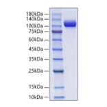 SDS-PAGE - Recombinant Mouse NCAM1 Protein (C-terminal His and Avi Tag) (A331764) - Antibodies.com