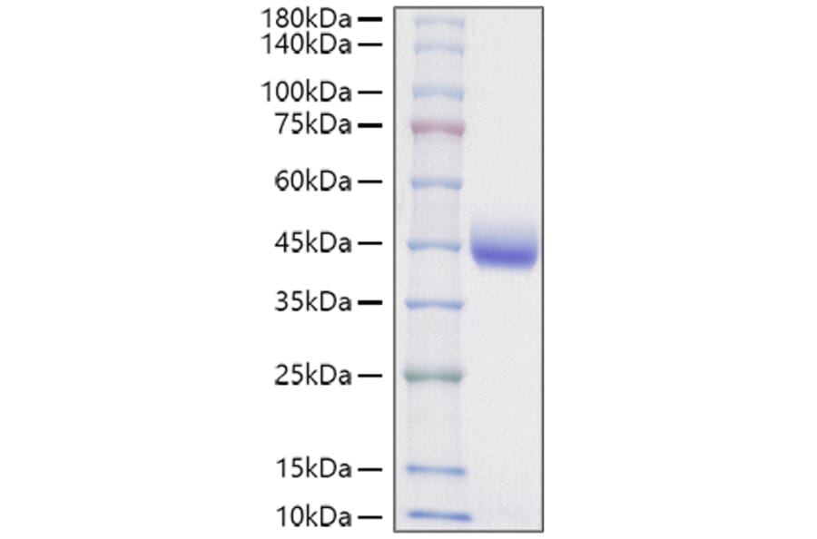 SDS-PAGE - Recombinant Mouse Nectin 2 Protein (C-terminal His Tag) (A331765) - Antibodies.com
