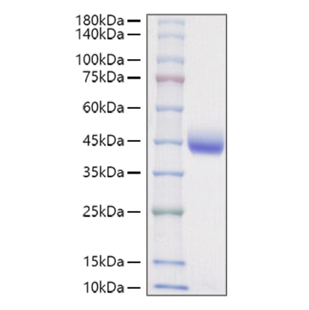 SDS-PAGE - Recombinant Mouse Nectin 2 Protein (C-terminal His Tag) (A331765) - Antibodies.com