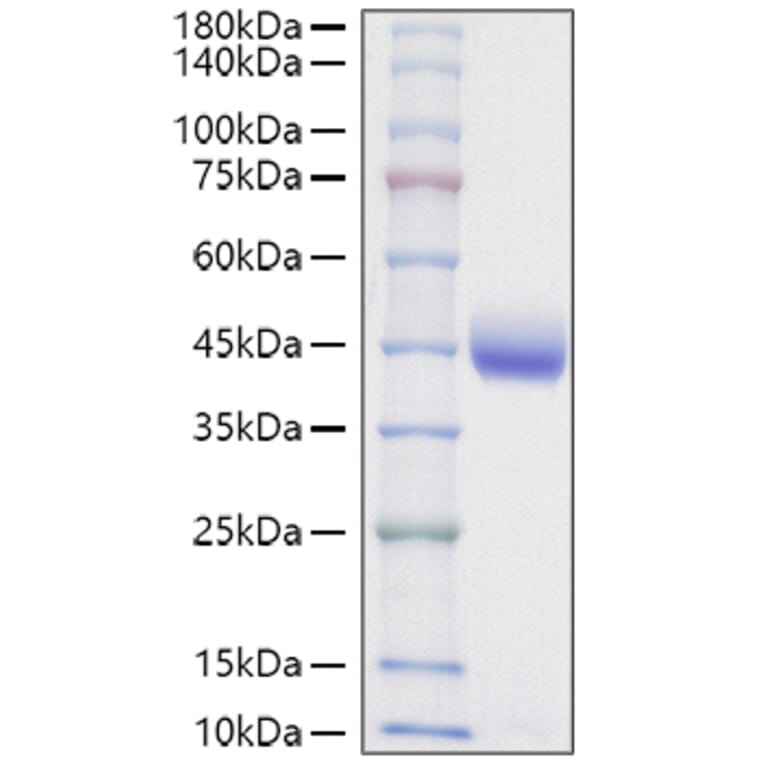 SDS-PAGE - Recombinant Mouse Nectin 2 Protein (C-terminal His Tag) (A331765) - Antibodies.com