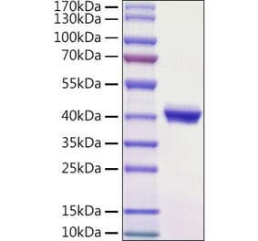 SDS-PAGE - Recombinant Mouse PVRL4 Protein (C-terminal His Tag) (A331766) - Antibodies.com