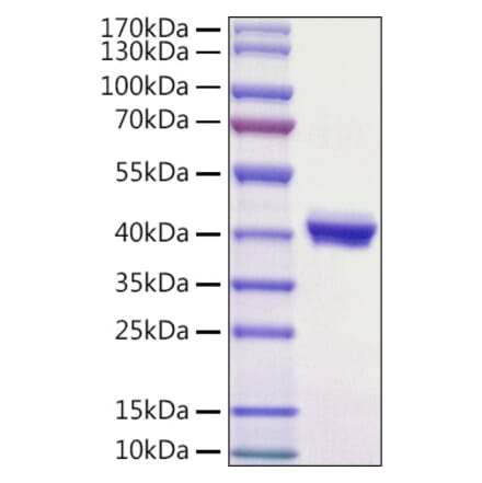 SDS-PAGE - Recombinant Mouse PVRL4 Protein (C-terminal His Tag) (A331766) - Antibodies.com
