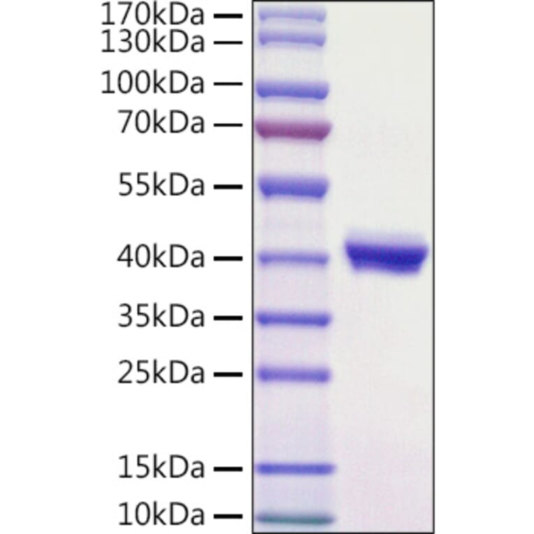 SDS-PAGE - Recombinant Mouse PVRL4 Protein (C-terminal His Tag) (A331766) - Antibodies.com