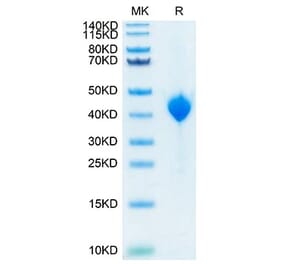 Tris-Bis PAGE - Recombinant Cynomolgus macaque PVRL4 Protein (C-terminal His Tag) (A331767) - Antibodies.com