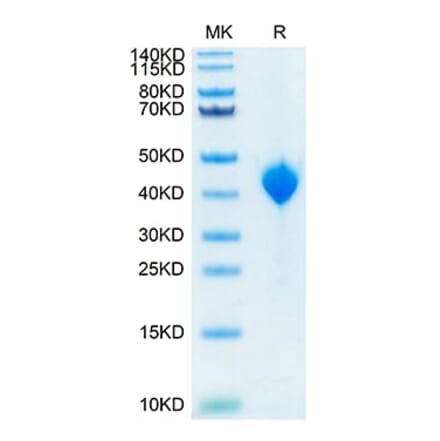 Tris-Bis PAGE - Recombinant Cynomolgus macaque PVRL4 Protein (C-terminal His Tag) (A331767) - Antibodies.com