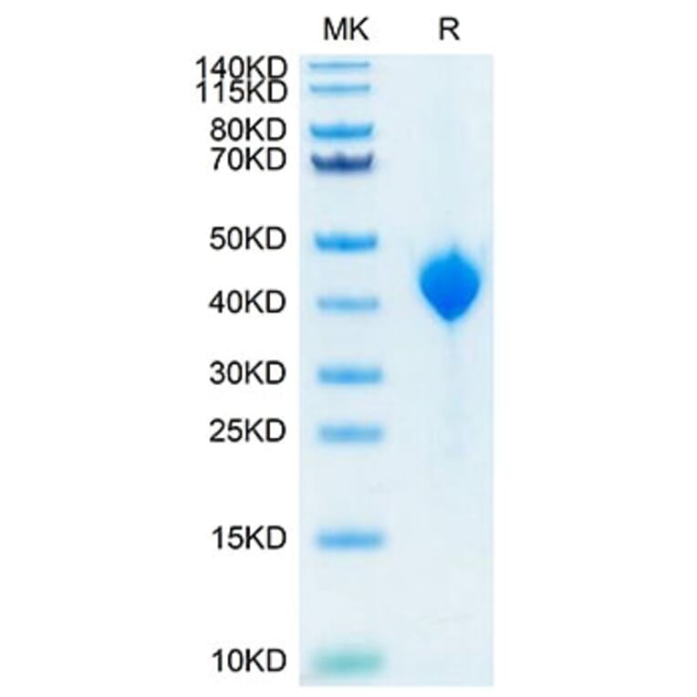 Tris-Bis PAGE - Recombinant Cynomolgus macaque PVRL4 Protein (C-terminal His Tag) (A331767) - Antibodies.com