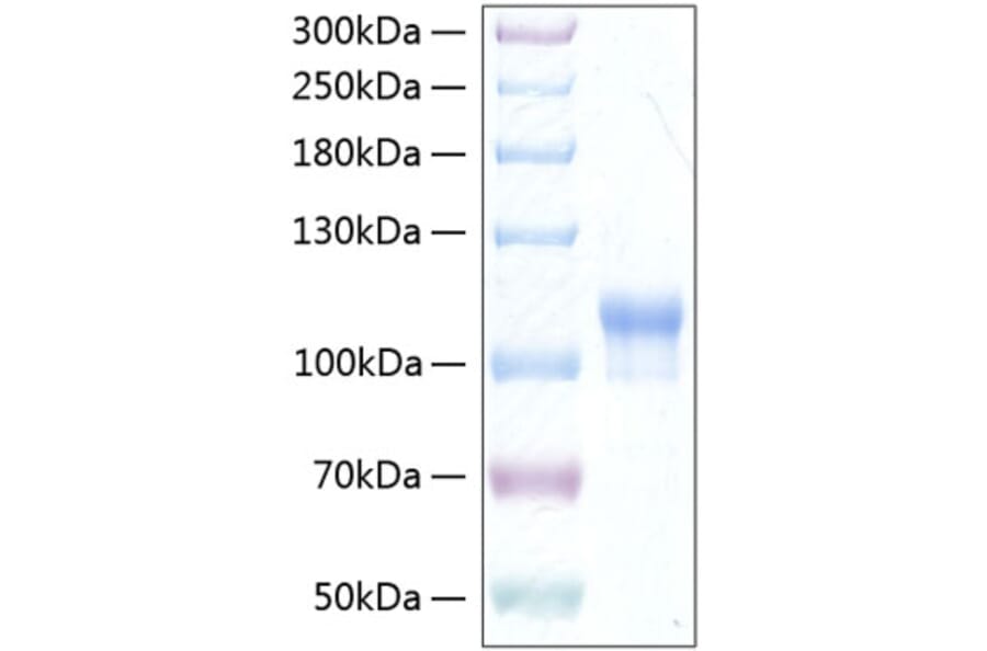 SDS-PAGE - Recombinant Human Neuroligin 3 Protein (C-terminal His Tag) (A331768) - Antibodies.com